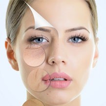 Cải thiện da khô nhăn Chống lão hóa